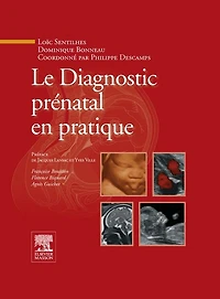 Le Diagnostic prénatal en pratique