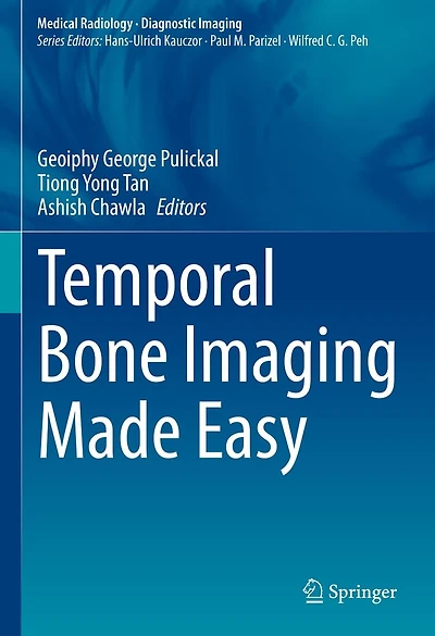 Temporal Bone Imaging Made Easy