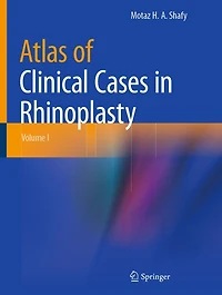 Atlas of Clinical Cases Rhinoplasty: Volume I