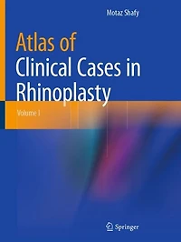 Atlas of Clinical Cases Rhinoplasty: Volume I