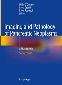 Imaging and Pathology of Pancreatic Neoplasms: A Pictorial Atlas