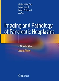 Imaging and Pathology of Pancreatic Neoplasms: A Pictorial Atlas