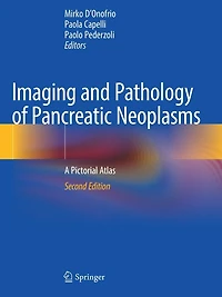 Imaging and Pathology of Pancreatic Neoplasms: A Pictorial Atlas