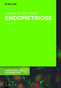 Endometriose: Ein Wegweiser für die Praxis