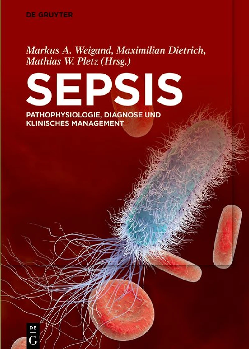 Sepsis: Pathophysiologie, Diagnose und klinisches Management