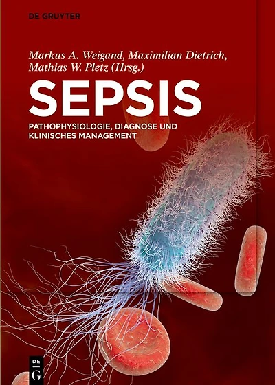 Sepsis: Pathophysiologie, Diagnose und klinisches Management