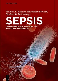 Sepsis: Pathophysiologie, Diagnose und klinisches Management