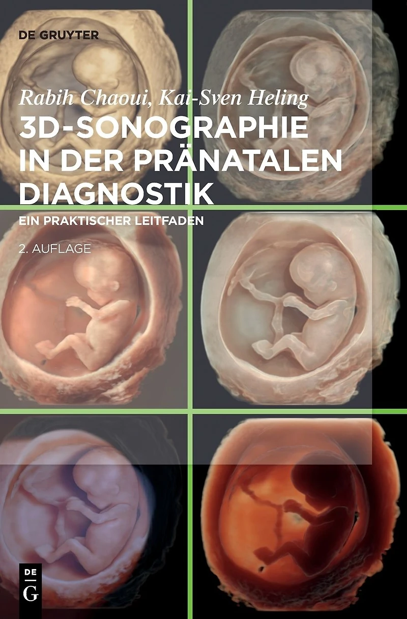 3D-Sonographie der pränatalen Diagnostik: Ein praktischer Leitfaden