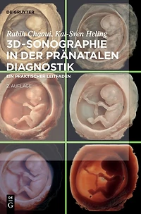 3D-Sonographie der pränatalen Diagnostik: Ein praktischer Leitfaden