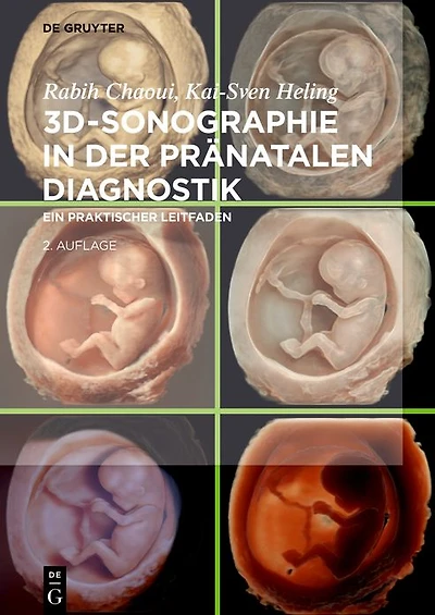 3D-Sonographie der pränatalen Diagnostik: Ein praktischer Leitfaden