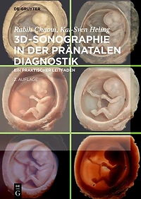 3D-Sonographie der pränatalen Diagnostik: Ein praktischer Leitfaden