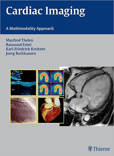Cardiac Imaging: A Multimodality Approach