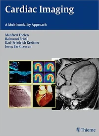 Cardiac Imaging: A Multimodality Approach