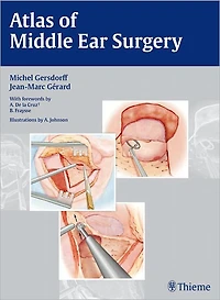 Atlas of Middle Ear Surgery