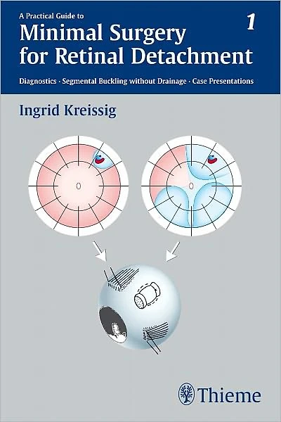 A Practical Guide to Minimal Surgery for Retinal Detachment, Vol. 1: Diagnostics, Segmental Buckling without Drainage, Case Presentations