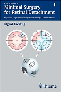 A Practical Guide to Minimal Surgery for Retinal Detachment, Vol. 1: Diagnostics, Segmental Buckling without Drainage, Case Presentations