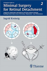 A Practical Guide to Minimal Surgery for Retinal Detachment, Vol. 2: Temporary Tamponades with Balloon and Gases without Drainage, Buckling versus Gases versus Vitrectomy, Reoperation, Case Presentations