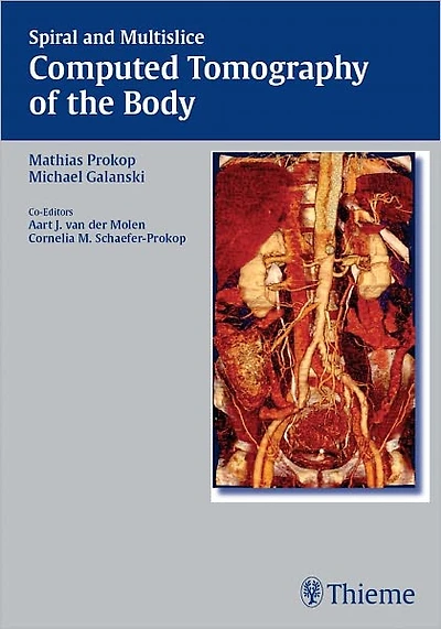 Spiral and Multislice Computed Tomography of the Body