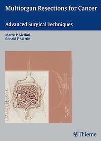 Multiorgan Resections for Cancer: Advanced Surgical Techniques