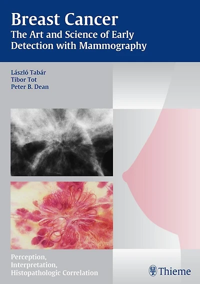 Breast Cancer - The Art and Science of Early Detection with Mammography: Perception, Interpretation