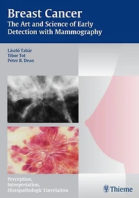 Breast Cancer - The Art and Science of Early Detection with Mammography: Perception, Interpretation