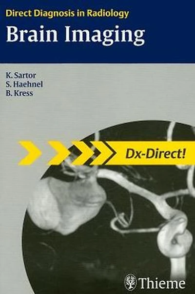 Brain Imaging: Direct Diagnosis in Radiology