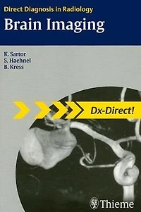 Brain Imaging: Direct Diagnosis in Radiology