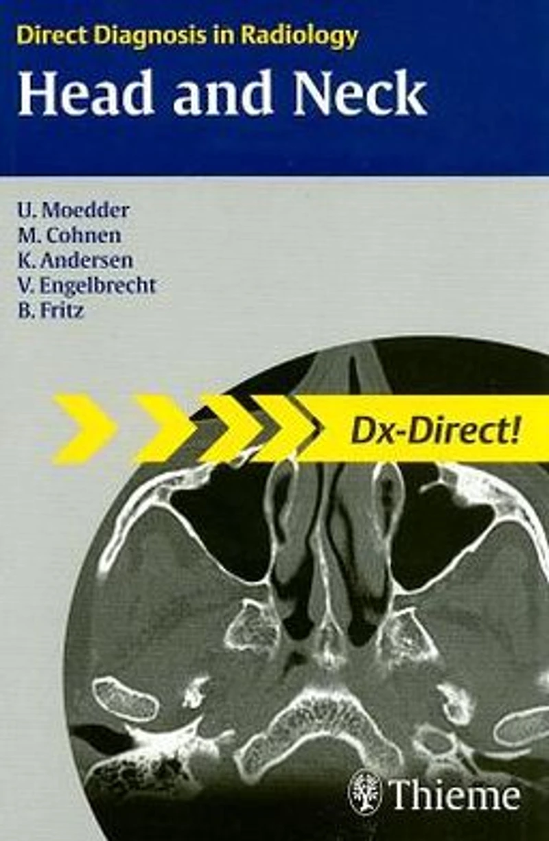 Head and Neck Imaging: Direct Diagnosis in Radiology