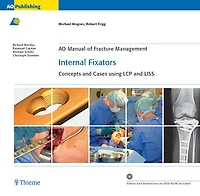 AO Manual of Fracture Management: Internal Fixators: Concepts and Cases using LCP and LISS