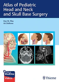 Atlas of Pediatric Head and Neck Skull Base Surgery