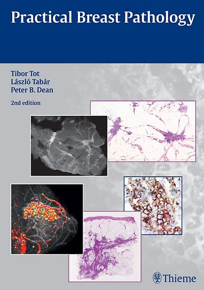 Practical Breast Pathology