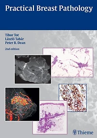 Practical Breast Pathology