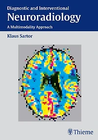 Diagnostic and Interventional Neuroradiology: A Multimodality Approach