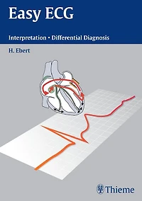 Easy ECG: Interpretation - Differential Diagnosis