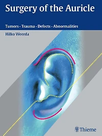 Surgery of the Auricle: Tumors - Trauma - Defects - Abnormalities