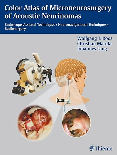 Color Atlas of Microsurgery of Acoustic Neurinomas: Endoscope-Assisted Techniques - Neuronavigational Techniques - Radiosurgery