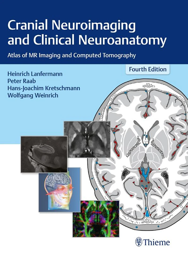 Cranial Neuroimaging and Clinical Neuroanatomy: Atlas of MR Imaging and Computed Tomography