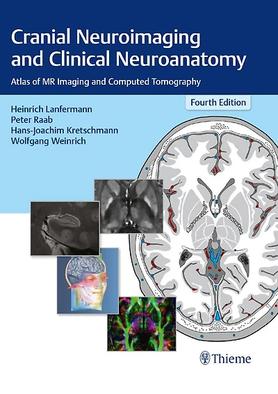 Cranial Neuroimaging and Clinical Neuroanatomy: Atlas of MR Imaging and Computed Tomography