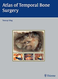Atlas of Temporal Bone Surgery