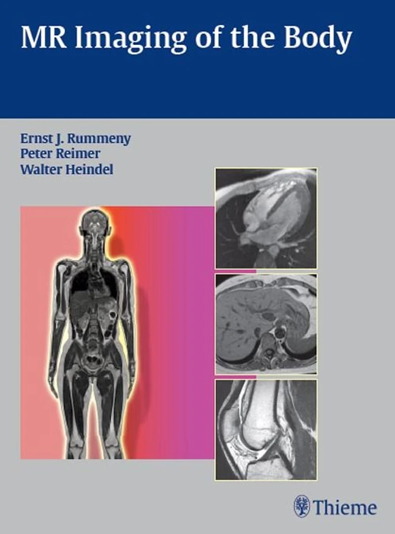 MR Imaging of the Body