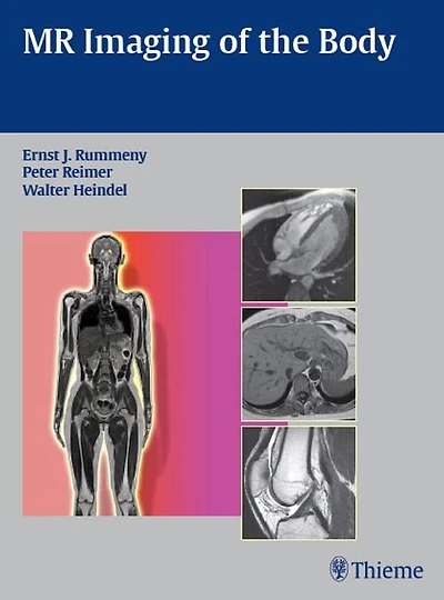 MR Imaging of the Body