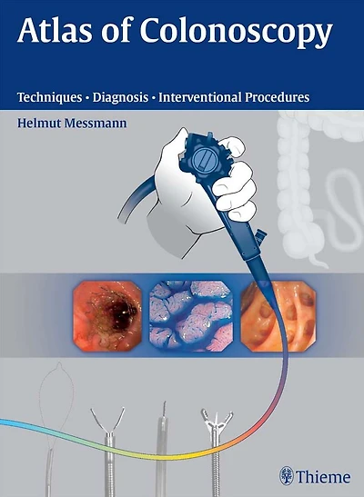 Atlas of Colonoscopy: Techniques - Diagnosis - Interventional Procedures