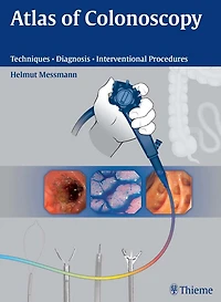 Atlas of Colonoscopy: Techniques - Diagnosis - Interventional Procedures