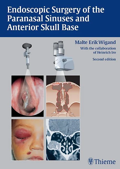 Endoscopic Surgery of the Paranasal Sinuses and Anterior Skull Base