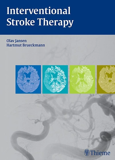 Interventional Stroke Therapy