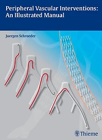 Peripheral Vascular Interventions: An Illustrated Manual