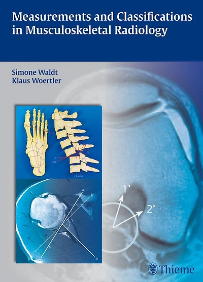 Measurements and Classifications in Musculoskeletal Radiology