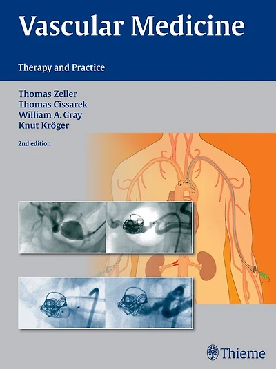 Vascular Medicine: Therapy and Practice