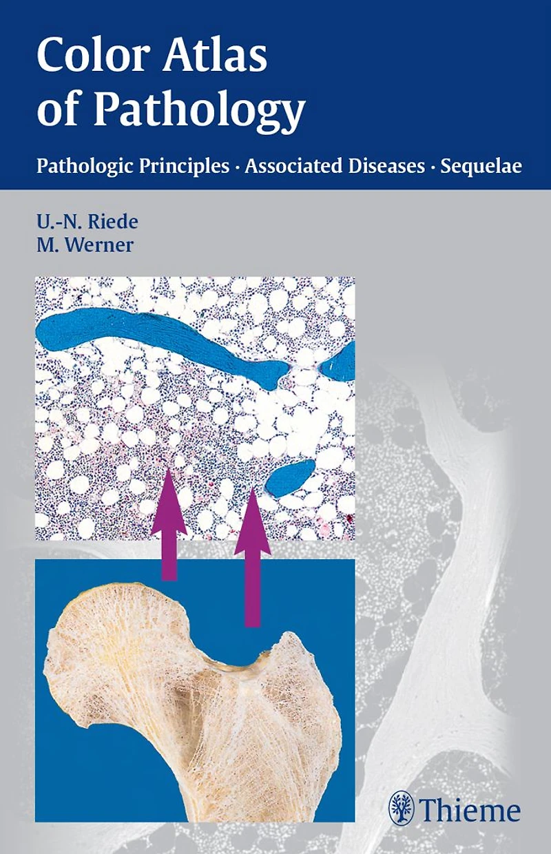 Color Atlas of Pathology: Pathologic Principles, Associated Diseases, Sequela