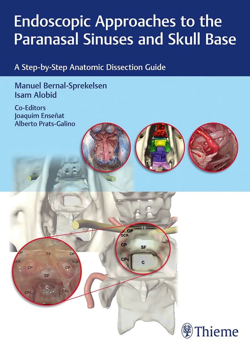 Endoscopic Approaches to the Paranasal Sinuses and Skull Base: A Step-by-Step Anatomic Dissection Guide